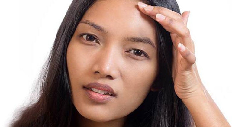 Women concerned about her skin condition