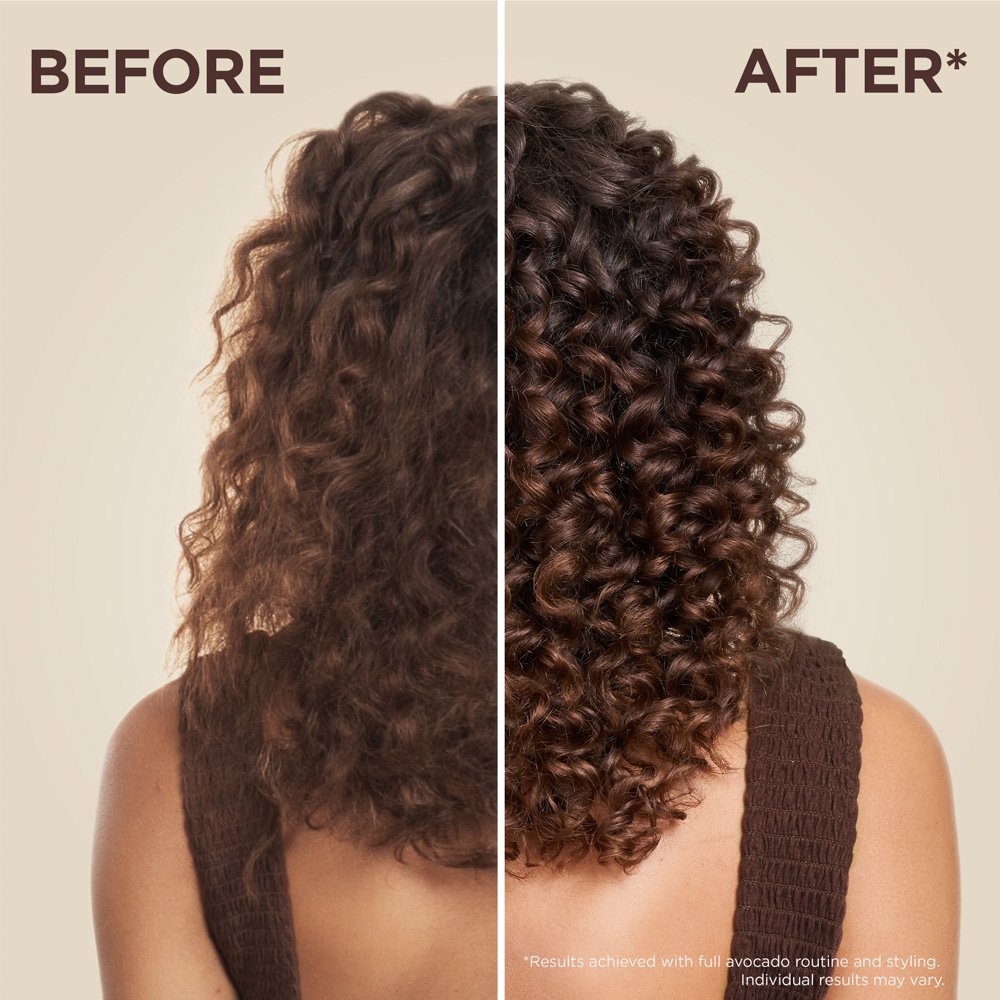 before after 806152